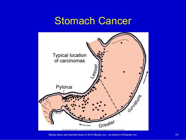 Alterations of the digestive function