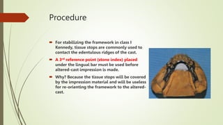 Procedure
 For stabilizing the framework in class I
Kennedy, tissue stops are commonly used to
contact the edentulous ridges of the cast.
 A 3rd reference point (stone index) placed
under the lingual bar must be used before
altered-cast impression is made.
 Why? Because the tissue stops will be covered
by the impression material and will be useless
for re-orienting the framework to the altered-
cast.
 