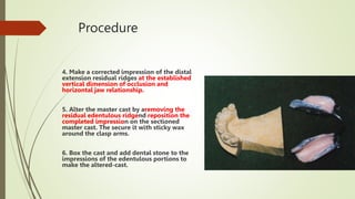 Procedure
4. Make a corrected impression of the distal
extension residual ridges at the established
vertical dimension of occlusion and
horizontal jaw relationship.
5. Alter the master cast by aremoving the
residual edentulous ridgend reposition the
completed impression on the sectioned
master cast. The secure it with sticky wax
around the clasp arms.
6. Box the cast and add dental stone to the
impressions of the edentulous portions to
make the altered-cast.
 