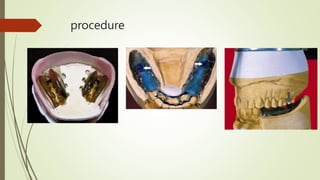 procedure
 