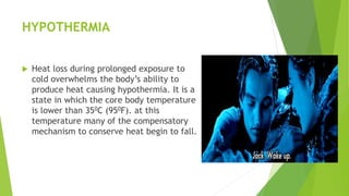HYPOTHERMIA
 Heat loss during prolonged exposure to
cold overwhelms the body’s ability to
produce heat causing hypothermia. It is a
state in which the core body temperature
is lower than 350C (950F). at this
temperature many of the compensatory
mechanism to conserve heat begin to fall.
 