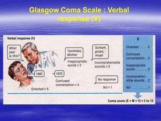 Glasgow Coma Scale : Verbal
response (V)
 