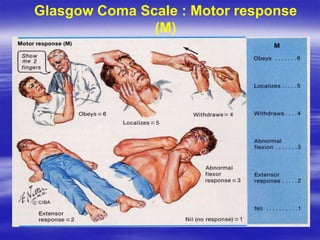 Glasgow Coma Scale : Motor response
(M)
 