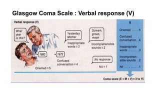 Glasgow Coma Scale : Verbal response (V)
 