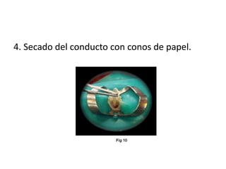 4. Secado del conducto con conos de papel. 
 