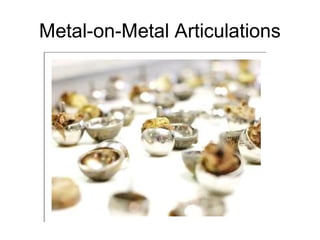 Metal-on-Metal Articulations
 