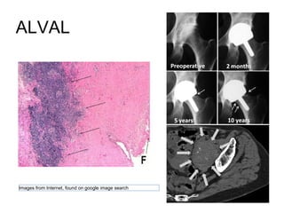 ALVAL
Images from Internet, found on google image search
 