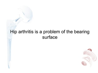 Hip arthritis is a problem of the bearing
surface
 
