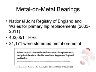 Metal-on-Metal Bearings
• National Joint Registry of England and
Wales for primary hip replacements (2003-
2011)
• 402,051 THRs
• 31,171 were stemmed metal-on-metal
 