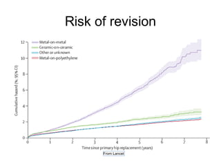 Risk of revision
From Lancet
 