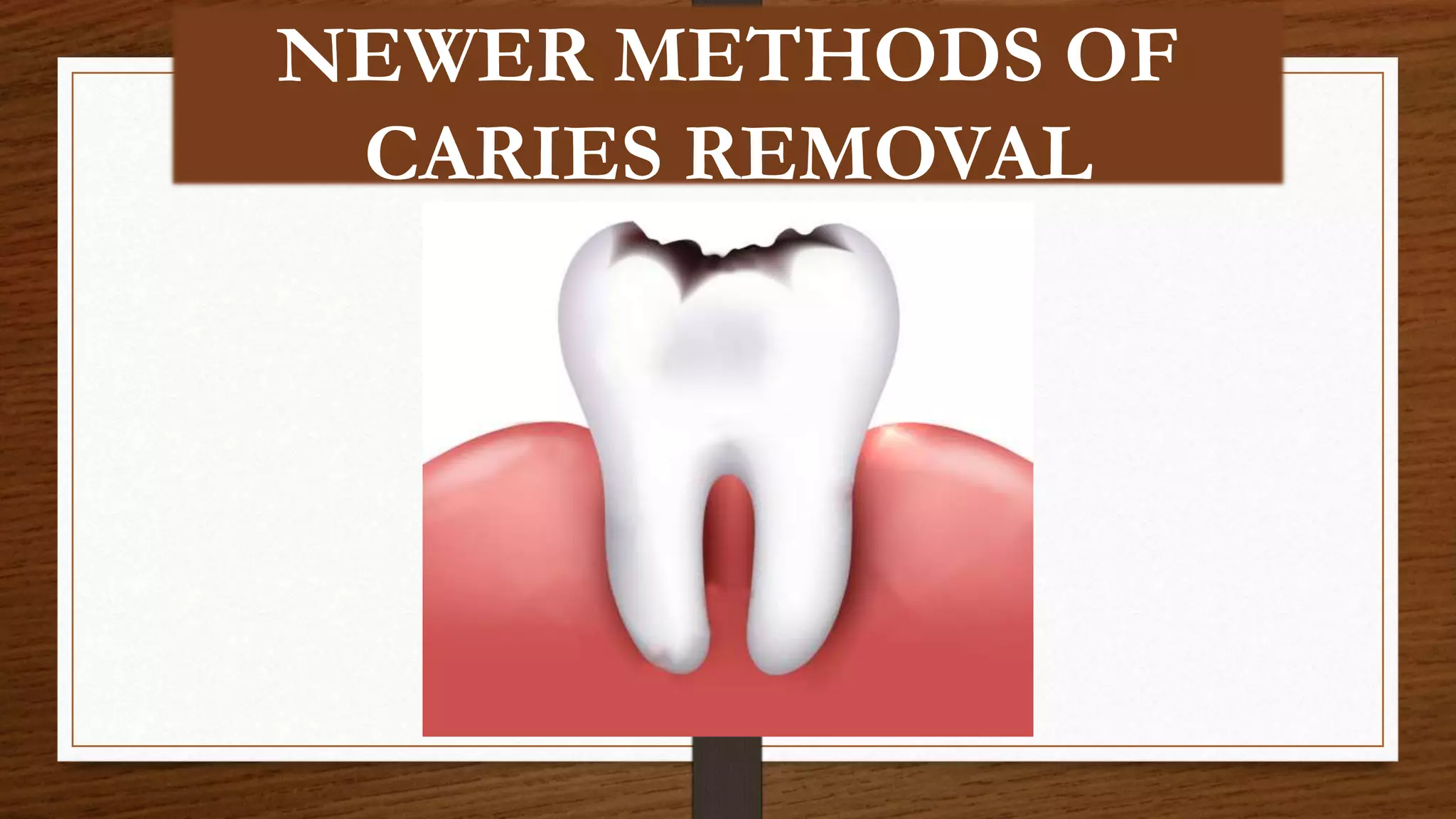 Alternative methods of caries removal (1) PPT