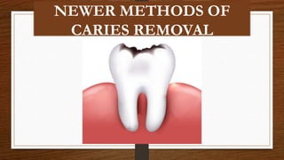 NEWER METHODS OF
CARIES REMOVAL
 