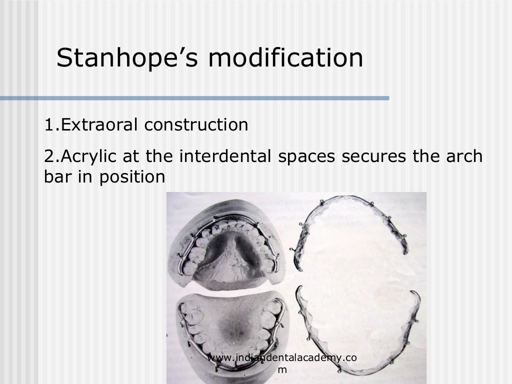 Alternative methods of fixation /dental courses