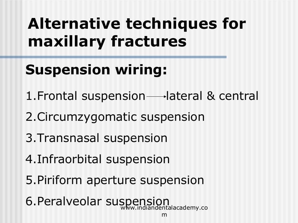 Alternative methods of fixation /dental courses