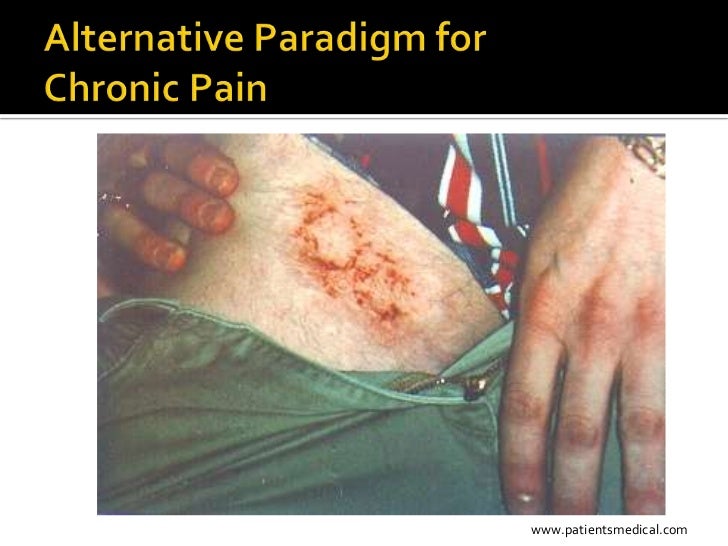 Alternative Pain Management Techniques that Heal the Pain Without A…