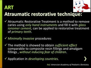 Alternatives to conventional cavity preparation in paedodontics | PPTX