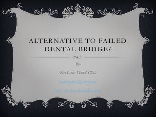 ALTERNATIVE TO FAILED
DENTAL BRIDGE?
By-
Best Laser Dental Clinic
bestdentalno1@gmail.com
http://bestlaserdentalclinic.com/
 