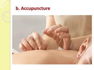 b. Accupuncture
 