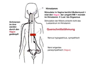 Hirnstamm
            Stimulator in Vagina berührt Muttermund +
            reizt den Vagus: der umgeht RM + mündet
            im Hirnstamm  Lust bis Orgasmus
            Stimulation der Klitoris erreicht nicht das
Schmerzen
              Lustzentrum im Hirnstamm
im Arm
werden
durch den     Querschnittslähmung
Vagus
gedämpft
               Nervus hypogastricus, sympathisch



               Nervi erigentes
               parasympathisch (Vagus)
 