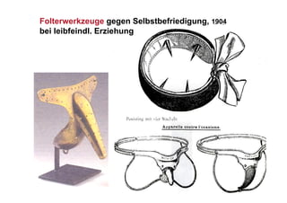 Folterwerkzeuge gegen Selbstbefriedigung, 1904
bei leibfeindl. Erziehung
 