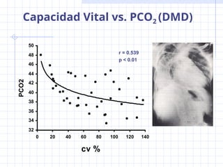 Diagnóstico y manejo de alteraciones en el control de la ventilación ...