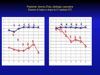 Paziente: donna 27aa; etiologia vascolare
Esame di base e dopo la IV seduta OTI

 