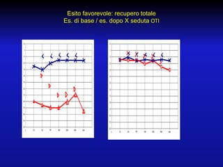 Esito favorevole: recupero totale
Es. di base / es. dopo X seduta OTI

 