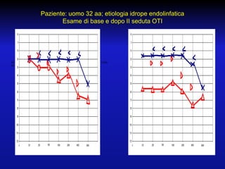 Paziente: uomo 32 aa; etiologia idrope endolinfatica
Esame di base e dopo II seduta OTI

ACUFENOMETRIA: Tono puro 3Hz
35 dB AU DX

ACUFENOMETRIA: Tono puro 1,5Hz
55 dB AU DX

 