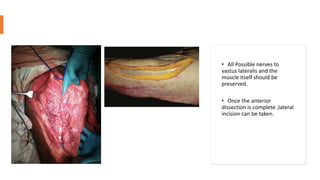 • All Possible nerves to
vastus lateralis and the
muscle itself should be
preserved.
• Once the anterior
dissection is complete ,lateral
incision can be taken.
 