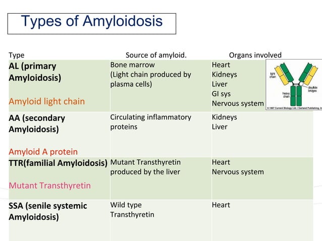 AL type Amyloidosis ppt.pptx | Heart and Cardiovascular Diseases ...