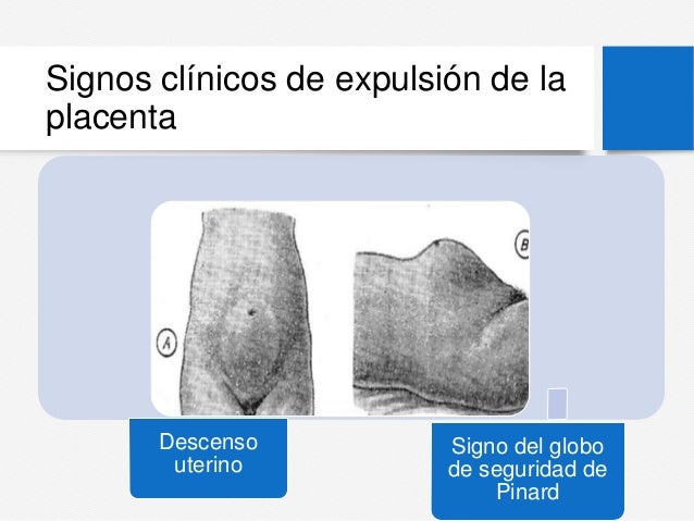 Alumbramiento y hemorragia postparto