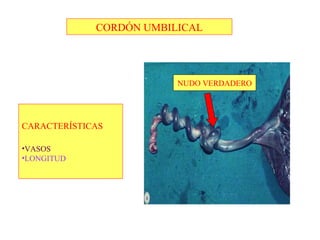 NUDO VERDADERO
CORDÓN UMBILICAL
CARACTERÍSTICAS
•VASOS
•LONGITUD
 
