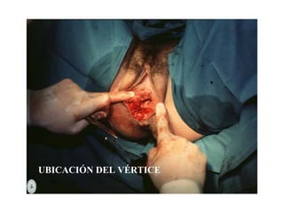 UBICACIÓN DEL VÉRTICE
 