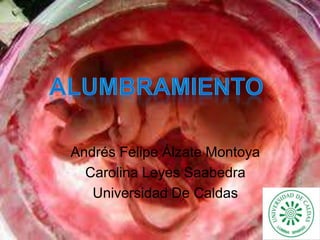 Andrés Felipe Álzate Montoya
Carolina Leyes Saabedra
Universidad De Caldas

 