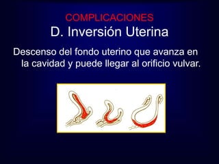 COMPLICACIONES 
D. Inversión Uterina 
Descenso del fondo uterino que avanza en 
la cavidad y puede llegar al orificio vulvar. 
 