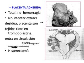 – PLACENTA ADHERIDA
• Total: no hemorragia
• No intentar extraer
desidua, placenta son
tejidos ricos en
tromboplastina,
entra en circulación
CIVD(coagulation
intravasculair disséminée )
• Histerectomía
 