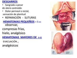 DESGARROS
• Sangrado a pesar
de útero contraído
• Dolor perineal o rectal,
sensación de plenitud
• REPARACIÓN - SUTURAS
HEMATOMAS PEQUEÑOS < 5 cc
observar,
compresas frías,
hielo, analgésico
HEMATOMAS MAYORES DE 5 CC
EVACUACIÓN ,
analgésicos
 