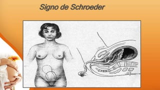 Signo de Schroeder
 
