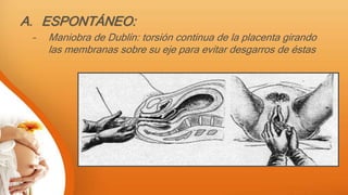 A. ESPONTÁNEO:
– Maniobra de Dublín: torsión continua de la placenta girando
las membranas sobre su eje para evitar desgarros de éstas
 