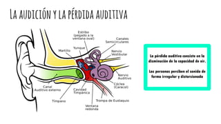 Laaudiciónylapérdidaauditiva
La pérdida auditiva consiste en la
disminución de la capacidad de oír.
Las personas perciben el sonido de
forma irregular y distorsionada
 