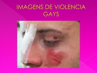 IMAGENS DE VIOLENCIA GAYS