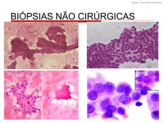 BI ÓPSIAS NÃO CIRÚRGICAS 