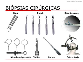 Cureta Punch Saca-bocados Estereotaxia Trefina Bisturi BI ÓPSIAS CIRÚRGICAS Alça de polipectomia 