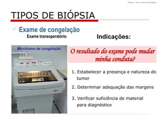 TIPOS DE BI ÓPSIA 1. Estabelecer a presença e natureza do tumor 2. Determinar adequação das margens 3. Verificar suficiência de material para diagnóstico Indicações: O resultado do exame pode mudar minha conduta? Exame de congelação  Exame transoperatório Micrótomo de congelação 