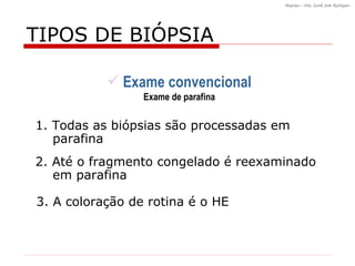 TIPOS DE BI ÓPSIA Exame convencional Exame de parafina 1. Todas as biópsias são processadas em parafina  3. A coloração de rotina é o HE 2. Até o fragmento congelado é reexaminado em parafina 