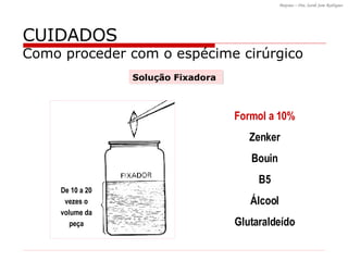CUIDADOS Como proceder com o espécime cirúrgico Formol a 10% Zenker Bouin B5 Álcool Glutaraldeído Solução Fixadora De 10 a 20 vezes o volume da peça 
