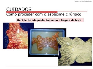 CUIDADOS Como proceder com o espécime cirúrgico Recipiente adequado: tamanho e largura da boca 