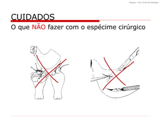 CUIDADOS O que  NÃO  fazer com o espécime cirúrgico 