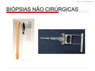 BI ÓPSIAS NÃO CIRÚRGICAS 