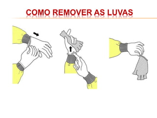 COMO REMOVER AS LUVAS
 